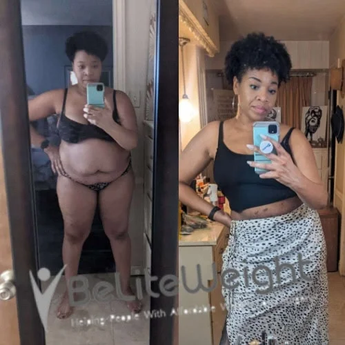 Kristin W - 1 Year Update*